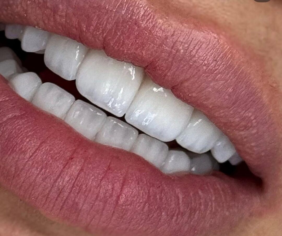 WhatsApp Image 2025-05-22 at 11.36.47 (2)